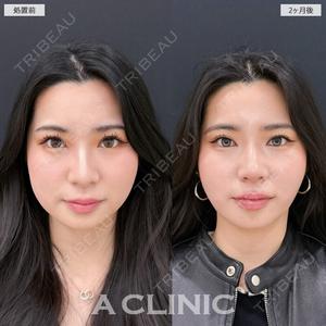 A CLINIC（エークリニック） 新宿院 瀬戸　翔太医師の症例