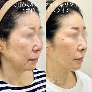 KAGA CLINICの症例