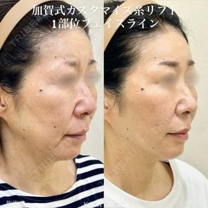 KAGA CLINICの症例