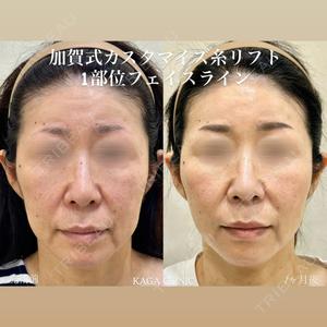 KAGA CLINICの症例