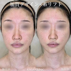 KAGA CLINICの症例