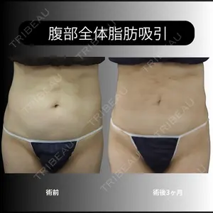 下北沢スキンクリニックの症例