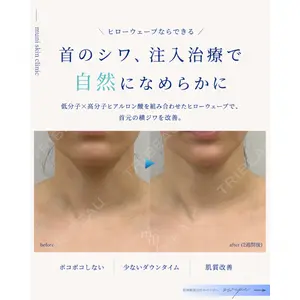muni skin clinic 高麗 惠理医師の症例