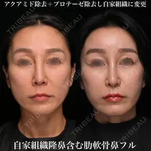 Zetith Beauty Clinic 銀座院 鉄 鑠医師の症例