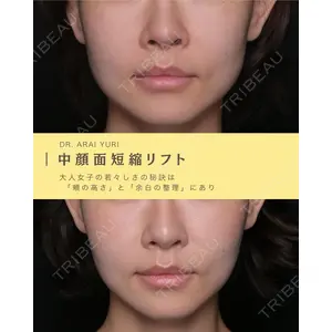 Zetith Beauty Clinic 新宿院 新井佑梨医師の症例
