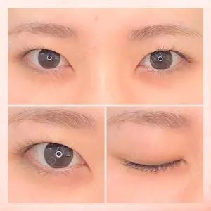 東京BELLEZZAクリニックの症例