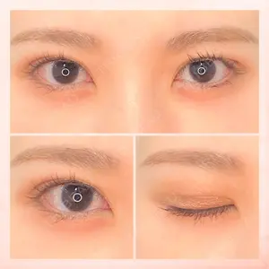 東京BELLEZZAクリニックの症例