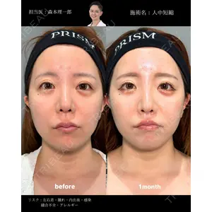 PRISM Beauty Clinic 町田院 森本 理一郎医師の症例