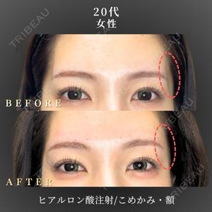 BiBiクリニック 山本 幸一郎医師の症例