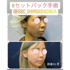 湘南美容クリニック 新橋銀座口院 内田 悠記医師の症例