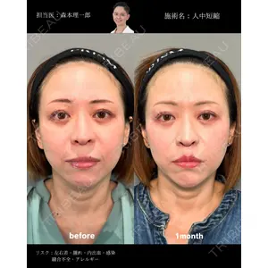PRISM Beauty Clinic 町田院 森本 理一郎医師の症例