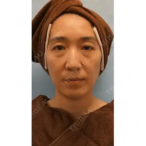 麹町皮ふ科・形成外科クリニックの症例