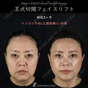 Zetith Beauty Clinic 新宿院 王 蘇医師の症例