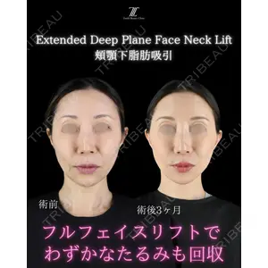 Zetith Beauty Clinic 新宿院 副島直人医師の症例