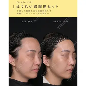 Zetith Beauty Clinic 新宿院 新井佑梨医師の症例