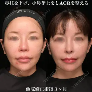 Zetith Beauty Clinic 銀座院 鉄 鑠医師の症例