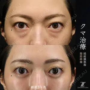 Zetith Beauty Clinic 新宿院 王 蘇医師の症例