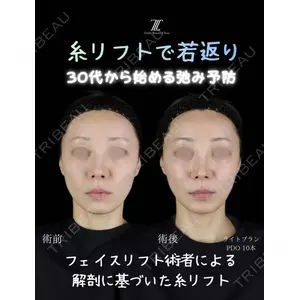 Zetith Beauty Clinic 新宿院 副島直人医師の症例