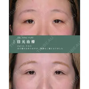 Zetith Beauty Clinic 新宿院 新井佑梨医師の症例