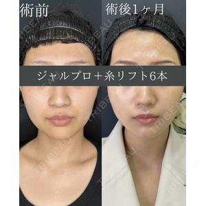 ルラ美容クリニック 名古屋本院 鶴田 佳雅医師の症例