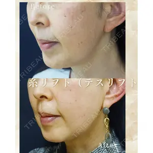 八戸タウン形成外科クリニック 立山 啓悦医師の症例
