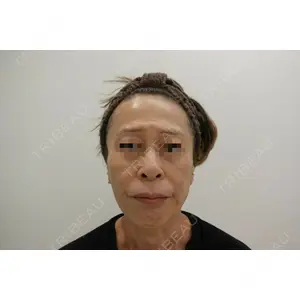 ユウコ形成外科クリニック 植田　有子医師の症例