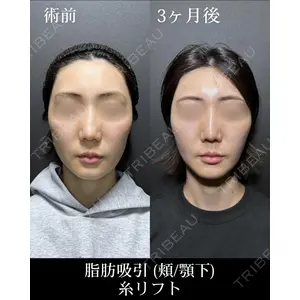 HAAB CLINIC 池袋院 野田 裕太郎　医師の症例