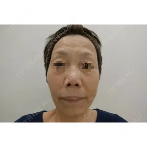 ユウコ形成外科クリニック 植田　有子医師の症例