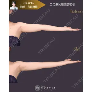 Casa de GRACIA GINZA 【カーサデグラシアギンザ】 吉田 直樹医師の症例