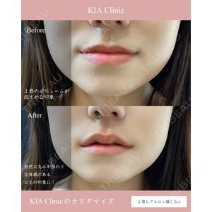 KIA CLINIC 心斎橋院 雲山　盛秀医師の症例