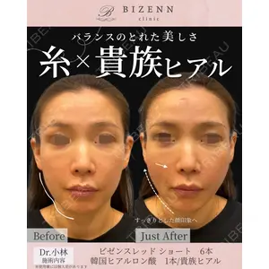 BIZENNクリニック【ビゼンクリニック】 小林 泰俊医師の症例