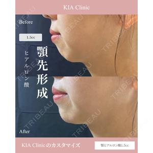 KIA CLINIC 心斎橋院 雲山　盛秀医師の症例