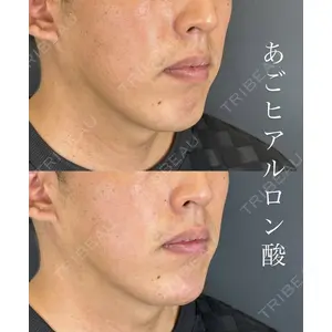 ルラ美容クリニック 広島院 角南 亮輔医師の症例