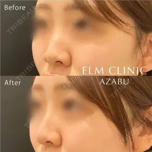 美容皮膚科エルムクリニック 福岡院の症例