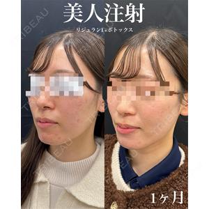 ルラ美容クリニック 郡山院 横瀬 晃平医師の症例