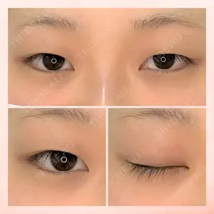 東京BELLEZZAクリニックの症例