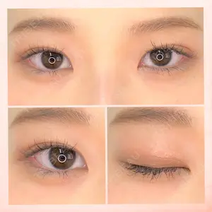 東京BELLEZZAクリニックの症例