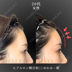 BiBiクリニック 山本 幸一郎医師の症例