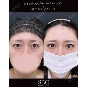 湘南美容クリニック 神戸三宮院 中川 卓医師の症例