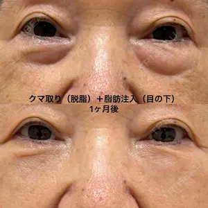 エターナル美容クリニック 久門田 詳医師の症例