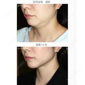 聖心美容クリニック 札幌院 前多 一彦医師の症例