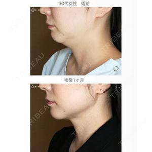 聖心美容クリニック 札幌院 前多 一彦医師の症例