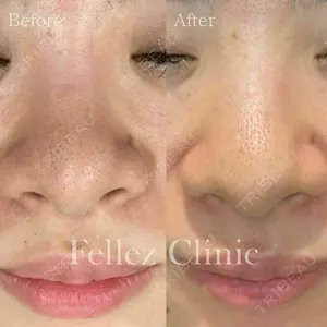 Fellez Clinic【フェルズクリニック】 小野 泰寛医師の症例