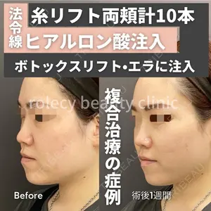 ロレシー美容クリニック 心斎橋駅前院 福留院長医師の症例