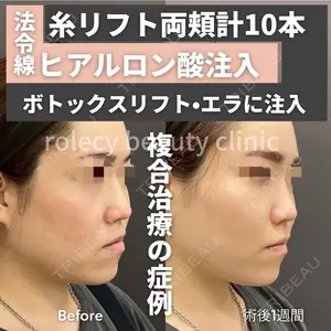 ロレシー美容クリニック 心斎橋駅前院 福留院長医師の症例