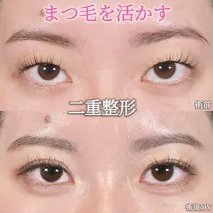 Zetith Beauty Clinic 池袋院 沈 竟卉医師の症例