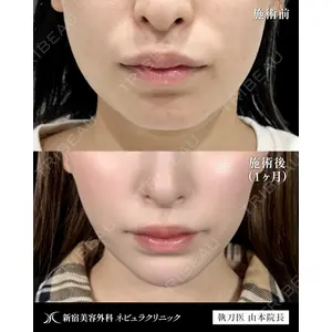 新宿美容外科ネビュラクリニック 山本 紘子医師の症例