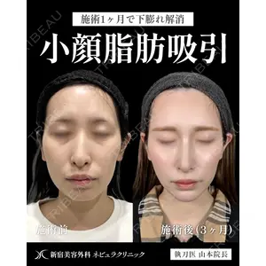 新宿美容外科ネビュラクリニック 山本 紘子医師の症例
