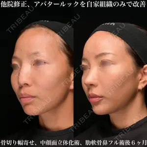 Zetith Beauty Clinic 銀座院 鉄 鑠医師の症例