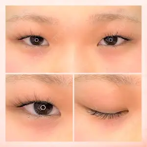 東京BELLEZZAクリニックの症例